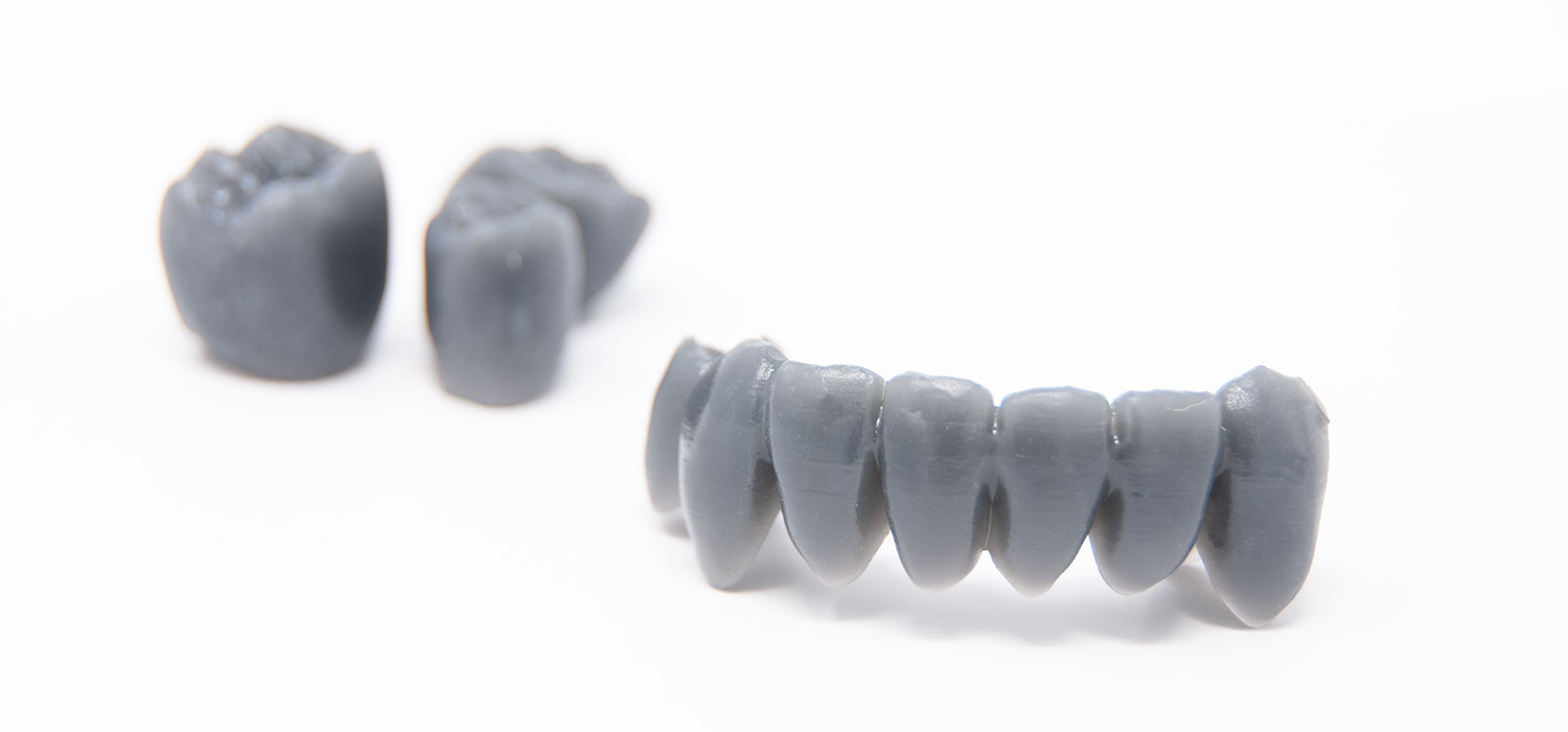 Provini in resina per odontotecnica realizzati tramite stampa 3D