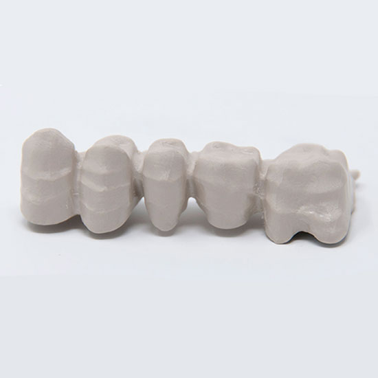 Peek the ideal solution for implant prostheses such as Toronto bridge, structures on natural abutments and abutments over implants, bridges and crowns to be stratified made of composite. 