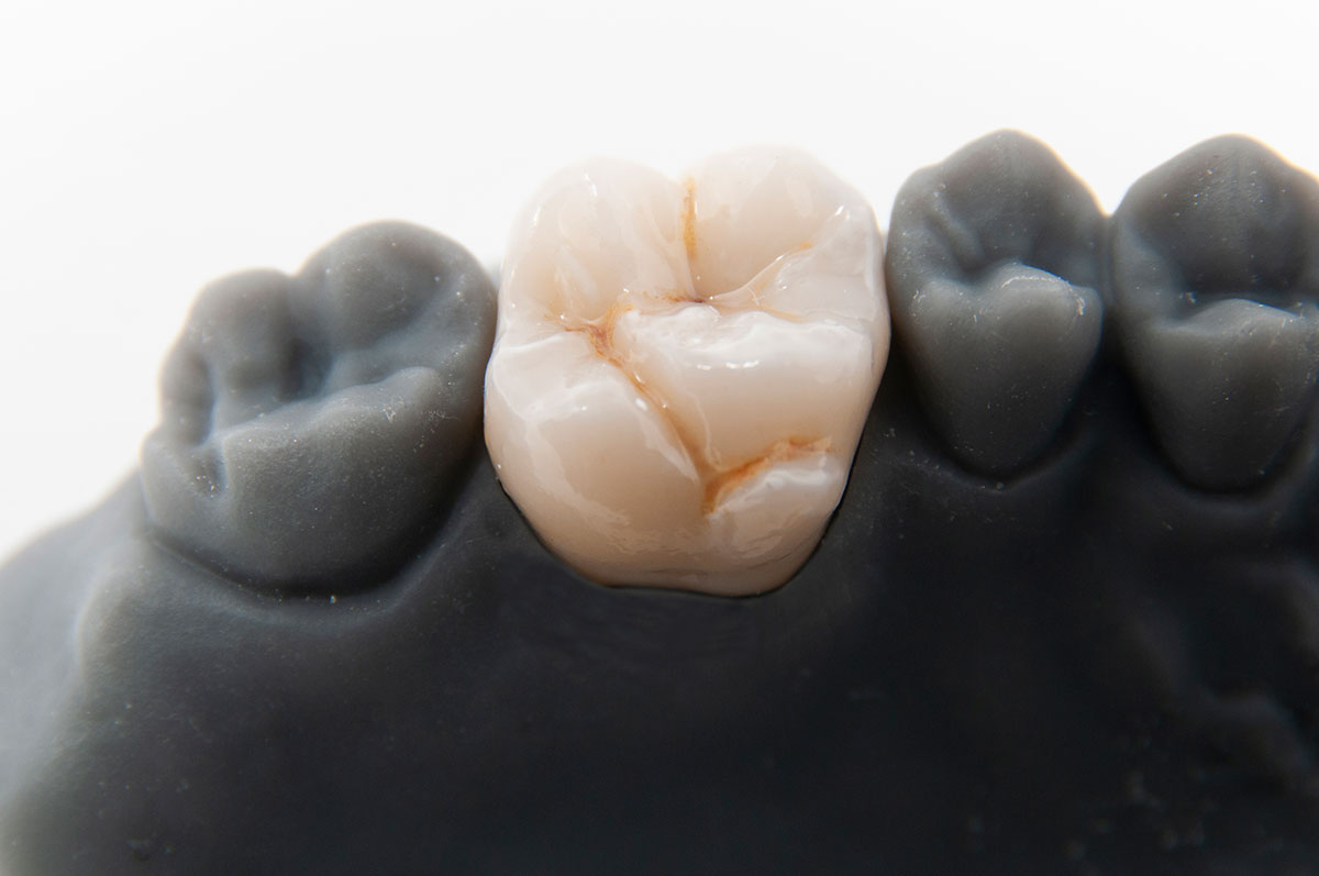 Semilavorato in Zirconia da file digitale