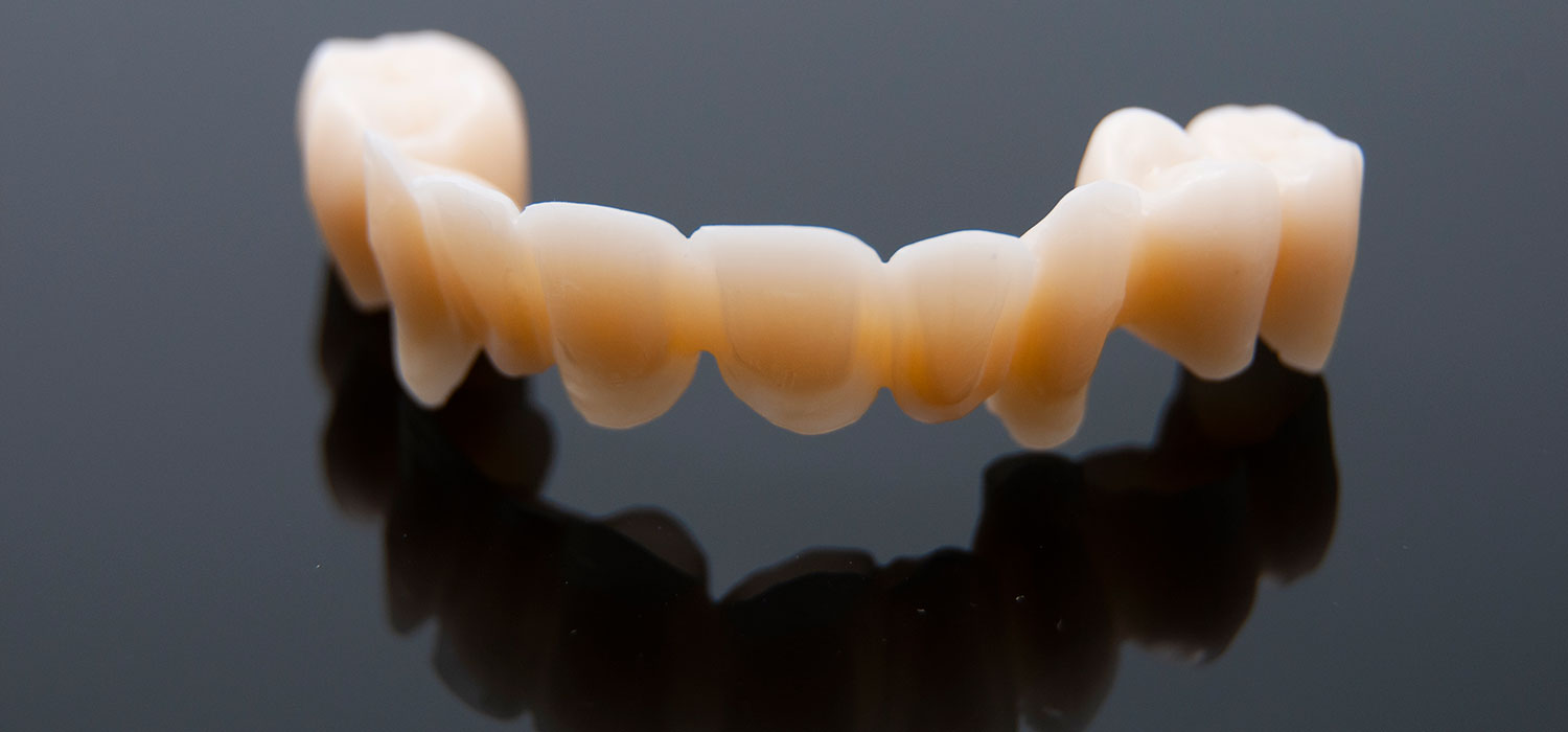 Ponte in zirconia