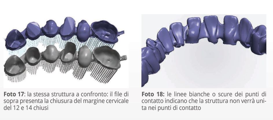 Guida alla progettazione di file .stl odontotecnici