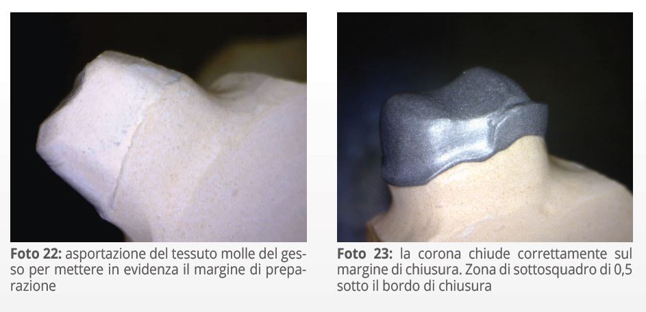 Guida alla progettazione di file .stl odontotecnici